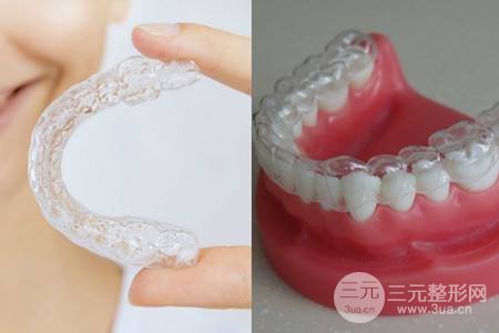 隐形牙齿矫正器多少钱一套?