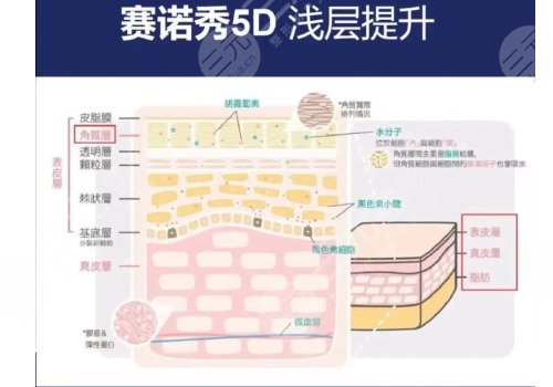 赛诺秀5D和超声炮哪个好？超声炮被“秒杀”？哪个才是面部抗衰王者？