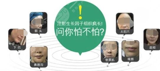 生长因子取出来后还会再长么？生长因子的危害副作用！看完觉得心惊胆战！