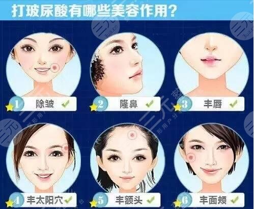 注射玻尿酸的作用与危害