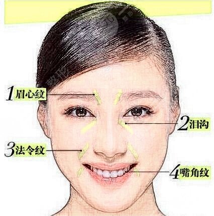 注射玻尿酸术前准备工作有哪些