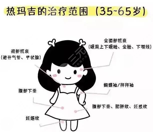 北京热玛吉个人真实感受