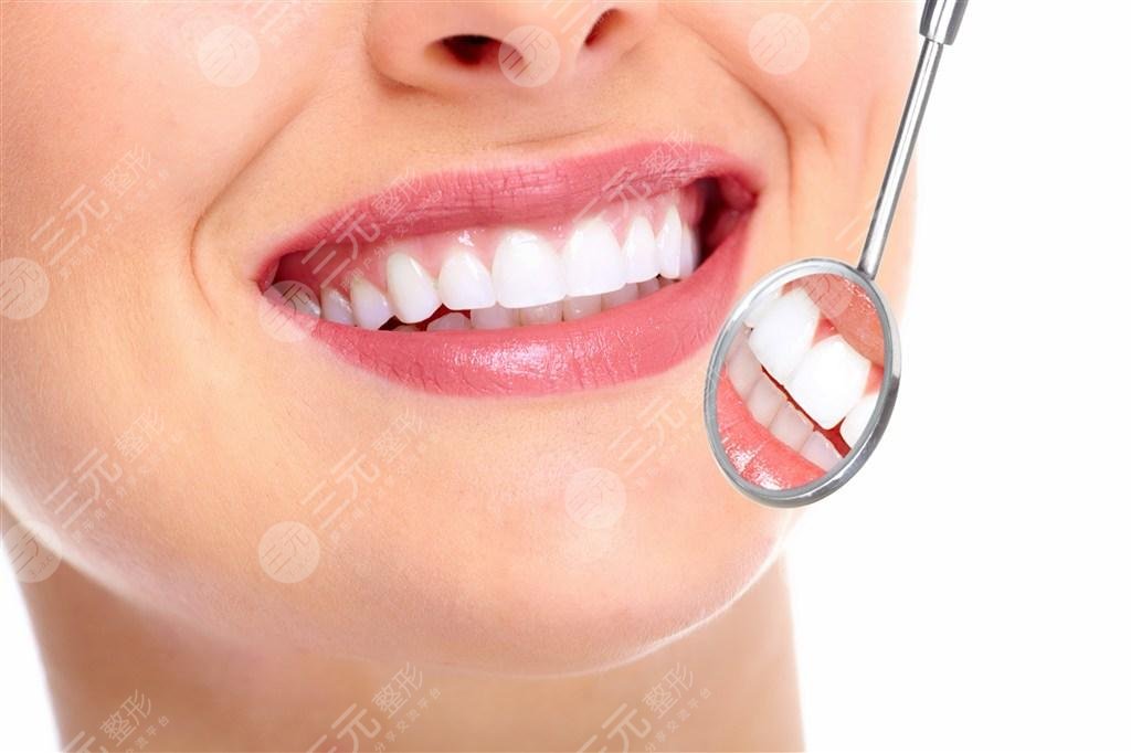 冷光牙齿美白有禁忌人群吗?