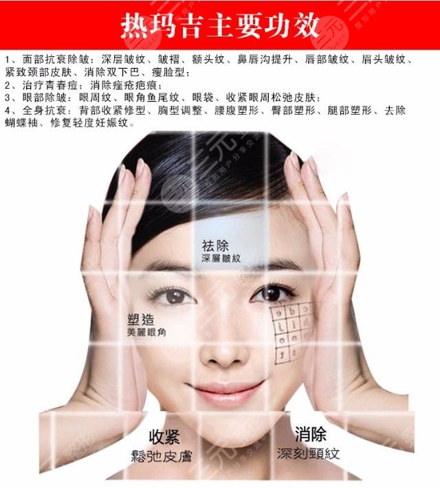 什么是热玛吉手术?