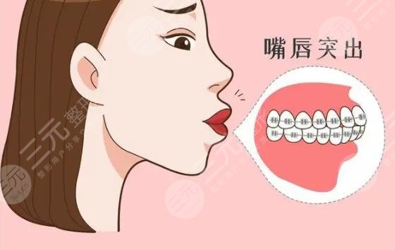 凸嘴