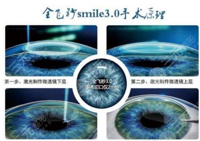 中山大学中山眼科中心擅长项目