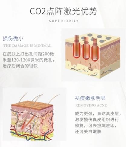 深圳市第二人民医院点阵激光手术效果