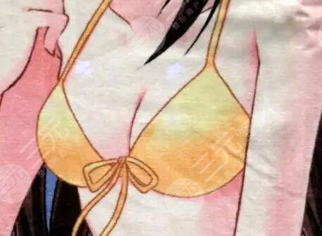 娜高假体