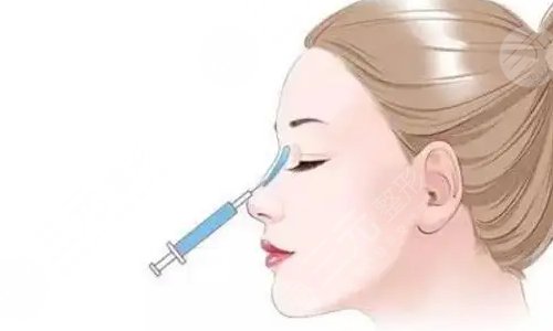 玻尿酸维持的时间和用的剂量有关吗?