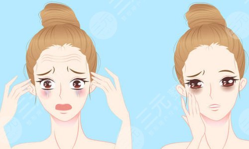 面部提拉多少钱？有什么特点？为什么要做？附注意事项