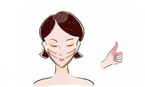 面部提拉多少钱？有什么特点？为什么要做？附注意事项