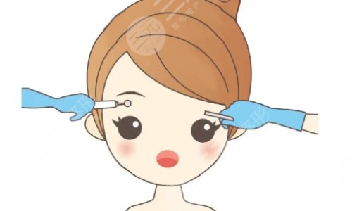 纹眉几天可以恢复自然?