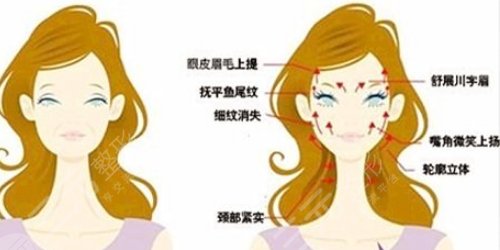 面部拉皮手术提升效果和视频赏析，多久能够恢复？赶紧look