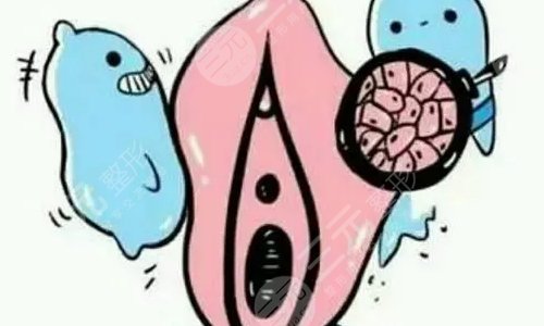 欧洲之星私密点阵激光有哪些好处呢?