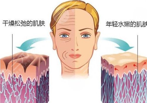 光子嫩肤祛斑效果怎么样？多少钱？价格表+禁忌人群+术后护理盘点！