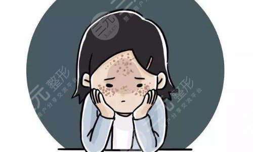 激光祛斑术后应该注意什么呢?