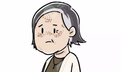 激光祛斑手术安全吗?