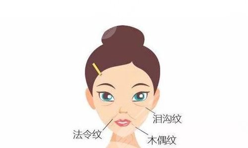 泪沟填充能维持多久？多少钱？价格表一览+填充雷区盘点！