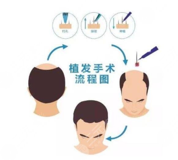 杭州三院发案例