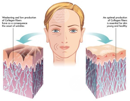 拉皮手术恢复期多少天？多少钱？价格一览表+注意事项分享！