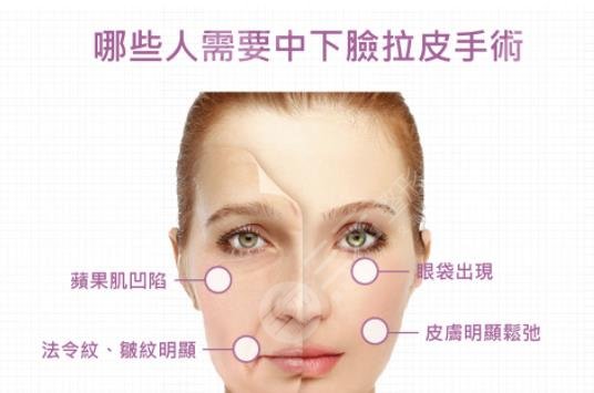 拉皮手术适合多大年龄做？手术费多少钱？价格一览表分享！