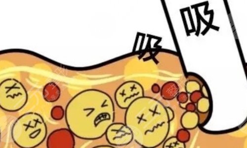 光纤溶脂原理是什么呢?