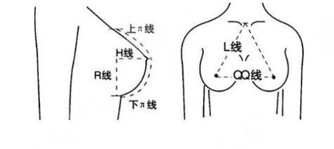 脂肪隆胸和假体隆胸哪个更没问题