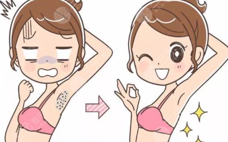 脱毛