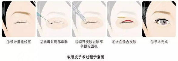 西京医院整形科擅长项目科普问答