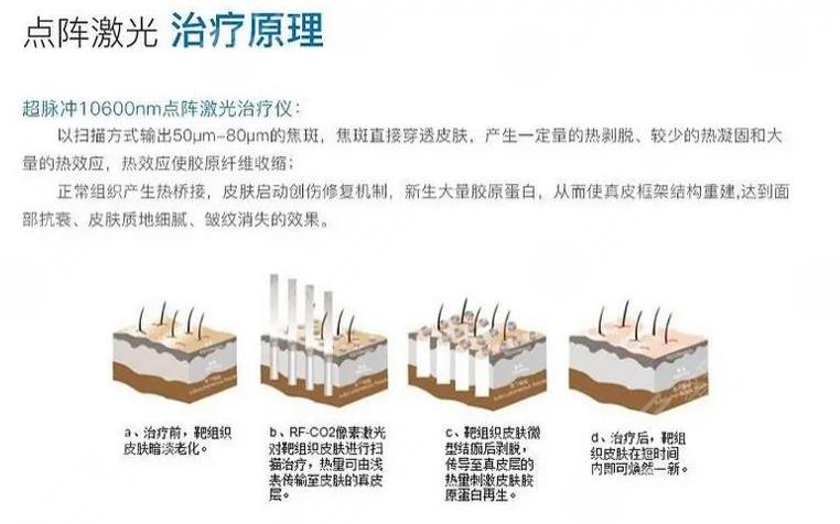 去疤痕