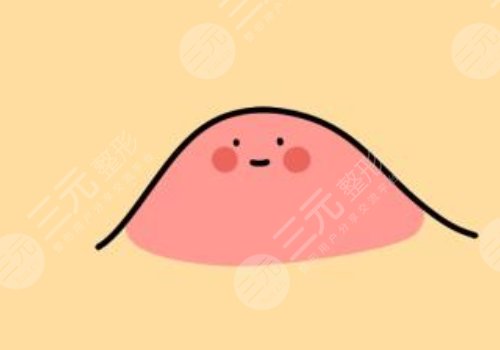 像素激光