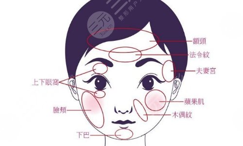 抗衰Q&A:自体脂肪填充面部能保持多长时间？果怎么样？疼吗？