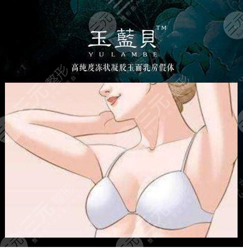 玉蓝贝假体怎么样?玉蓝贝假体隆胸优势+真人术后:老公和我都高兴坏了