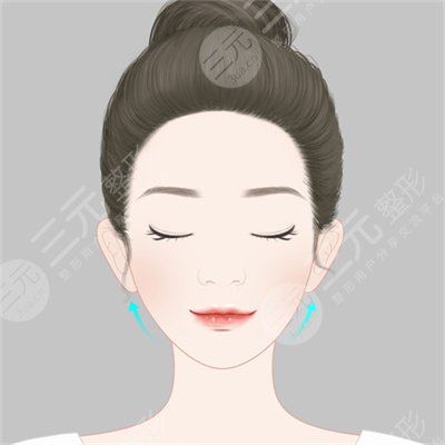 不要对整容大惊小怪