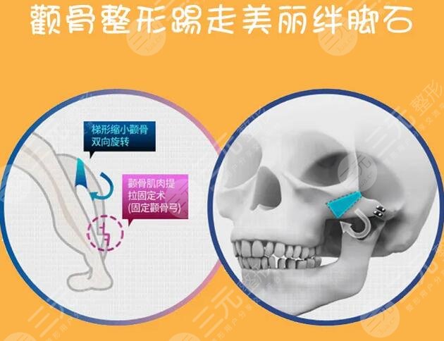 颧骨磨骨能磨几毫米