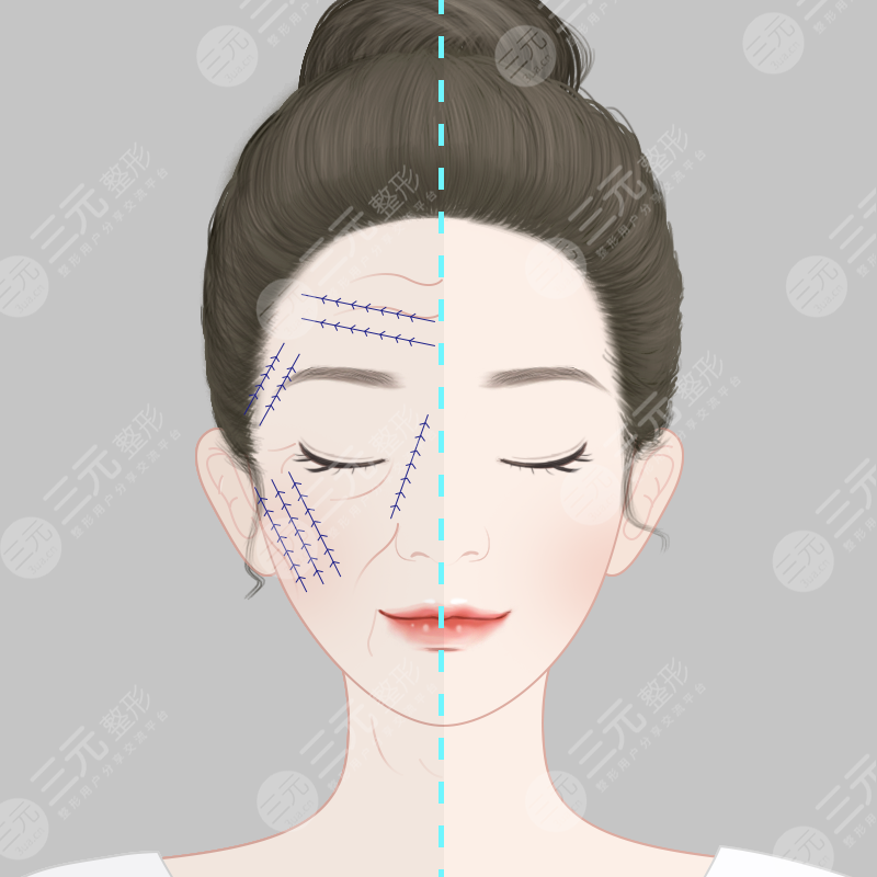 黄大勇改脸型怎么样