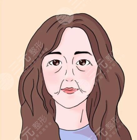 热玛吉除皱抗衰项目案例体验反馈: