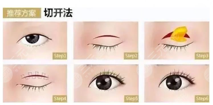 眼部整形手术