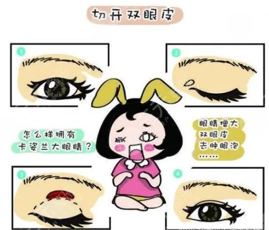 眼部手术是什么