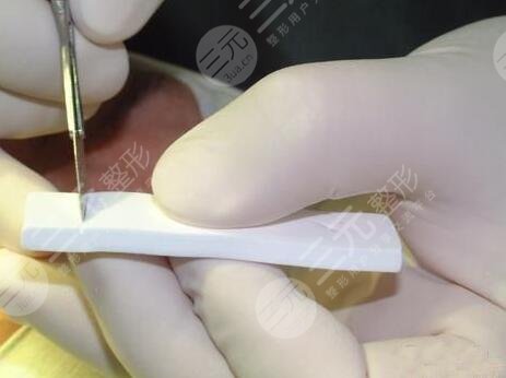 女性鼻子痣脸相分析 