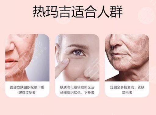 热玛吉项目前需要注意事项