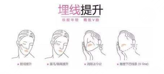 脸部紧致提升紧致多少钱?