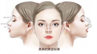 何栋良做鼻子案例图片