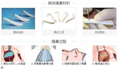 何栋良做鼻子案例图片