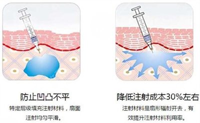 鞠婧祎整容了吗？四千年一遇美女深度扒一扒~