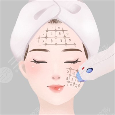 热玛吉真人体验过程记录