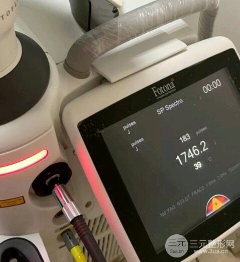 4D火凤凰面部溶脂图片真实测评