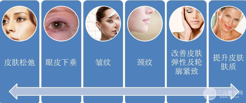 美容热玛吉的作用