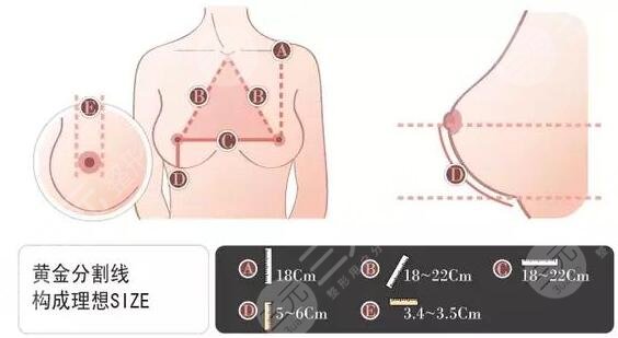 伊美尔健翔医院隆胸果