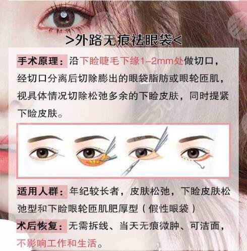 上海去眼袋果术前